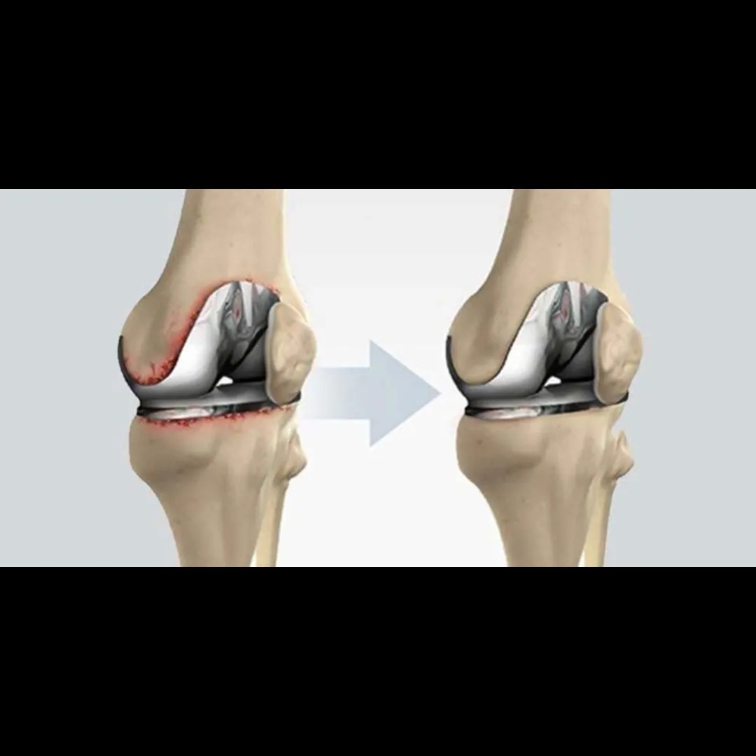 Joint Replacement Surgeon Nashik