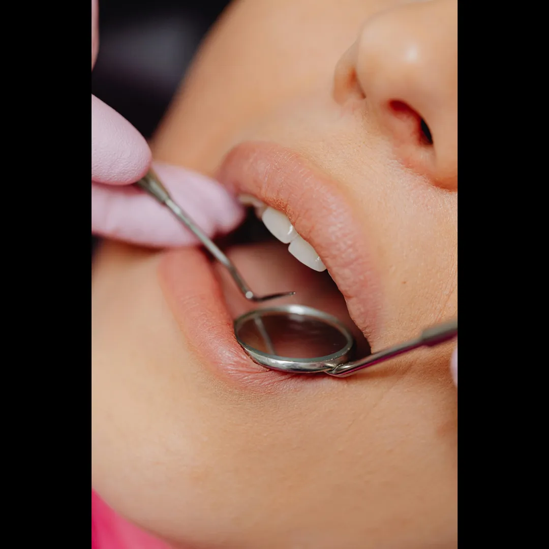 Painless Dental Treatment in Charni Road Mumbai
Dental care doesn't have to hurt. With modern techno...