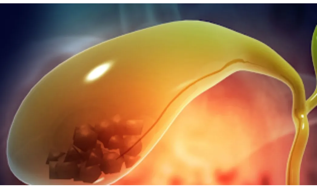 Gallstones surgeon in Navi Mumbai – Effective Solutions for Digestive Wellness
