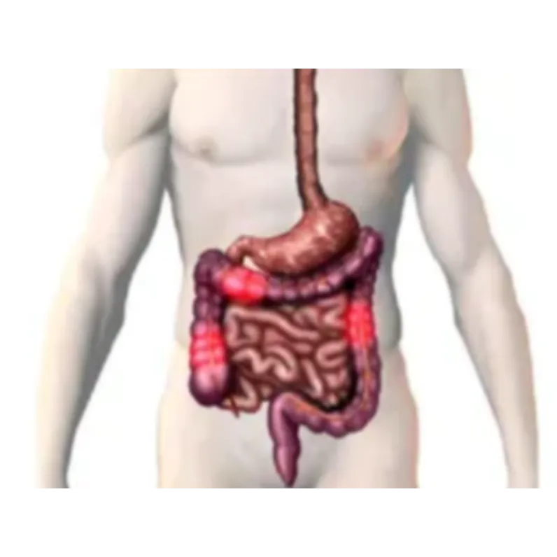 Chronic Diarrhoea Treatment in Mumbai