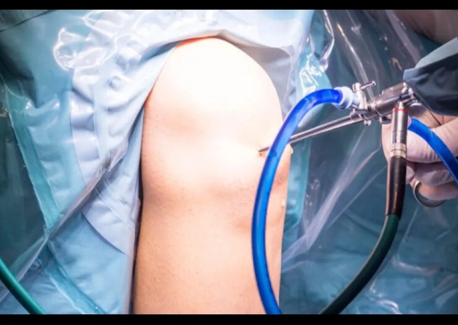 Arthroscopy services in Pimpri-Chinchwad