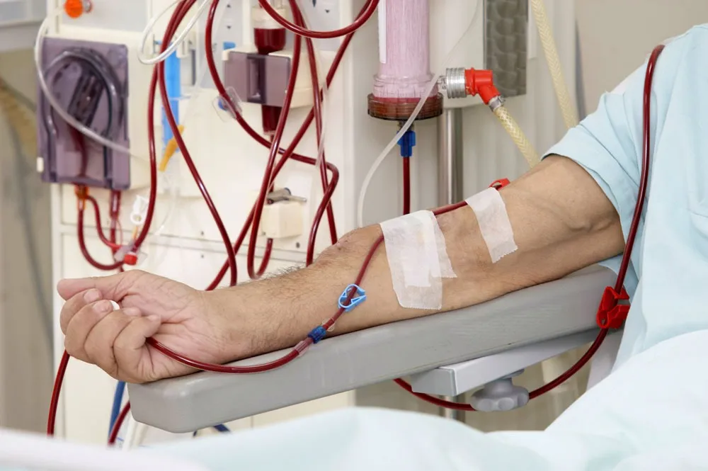 Best Dialysis treatment in Moshi