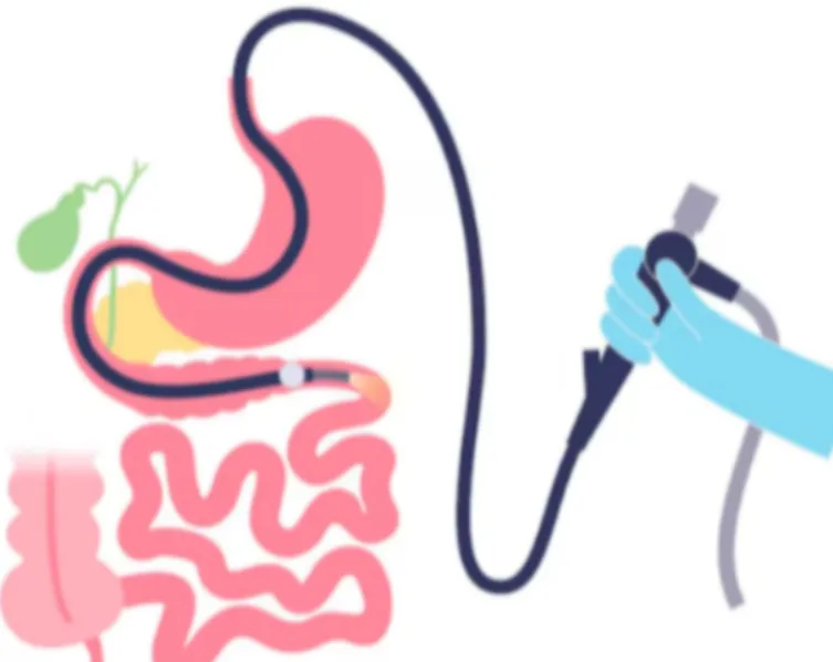 Double Balloon Enteroscopy in Mumbai