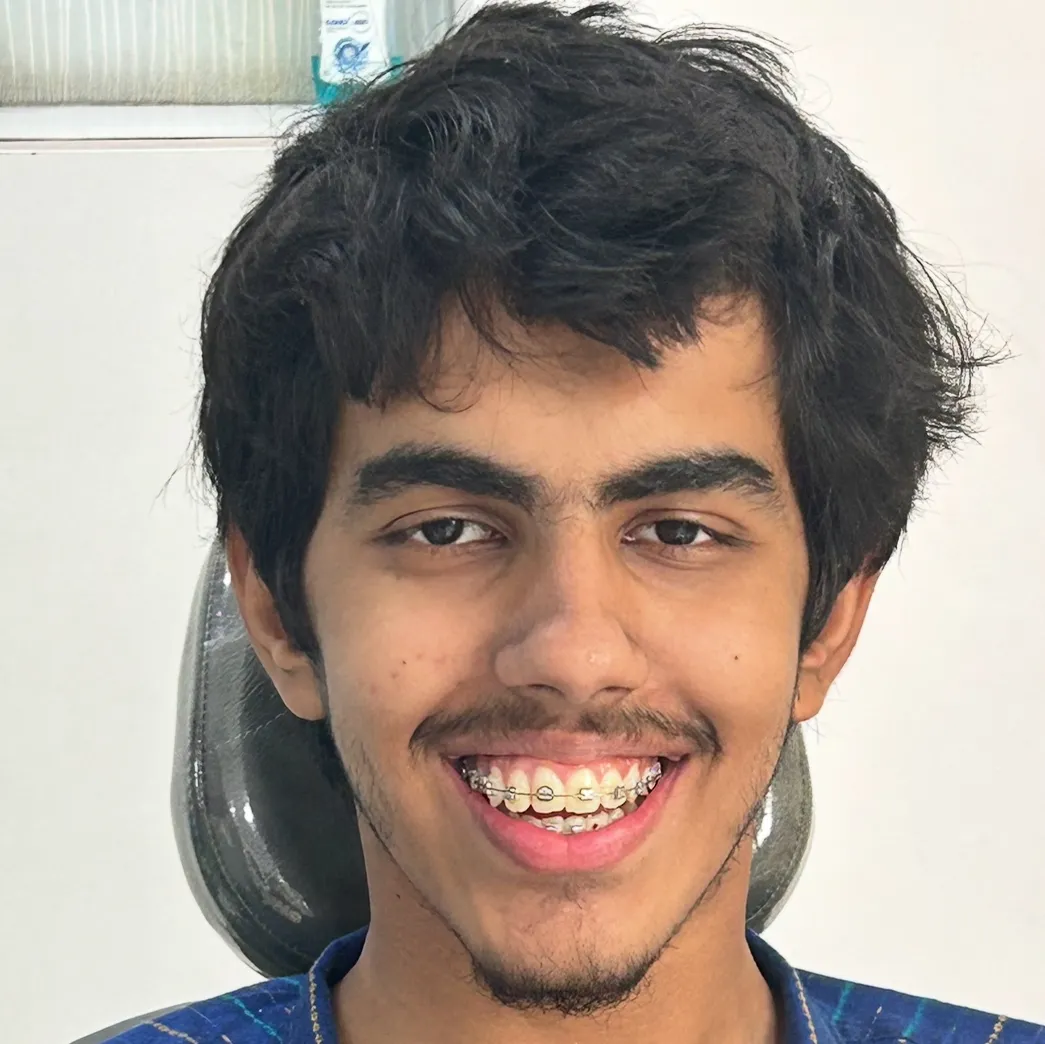 Life with Braces: Comfort, Care & Confidence Tips | Align and Smile Dental Care, Sector 18 Noida
