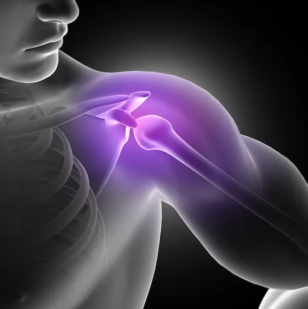 Reverse Shoulder Replacement in Bangalore – Regaining Shoulder Function
