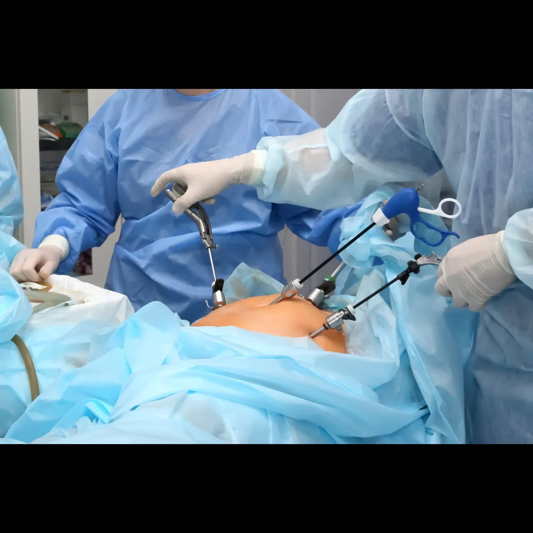 General and Laparoscopic Surgery in Moshi