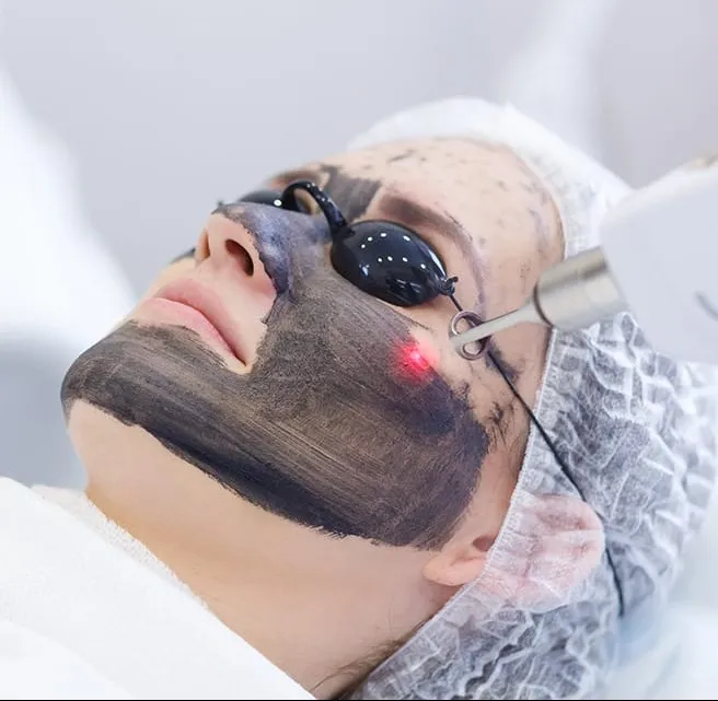 Best carbon leser treatment in nerul