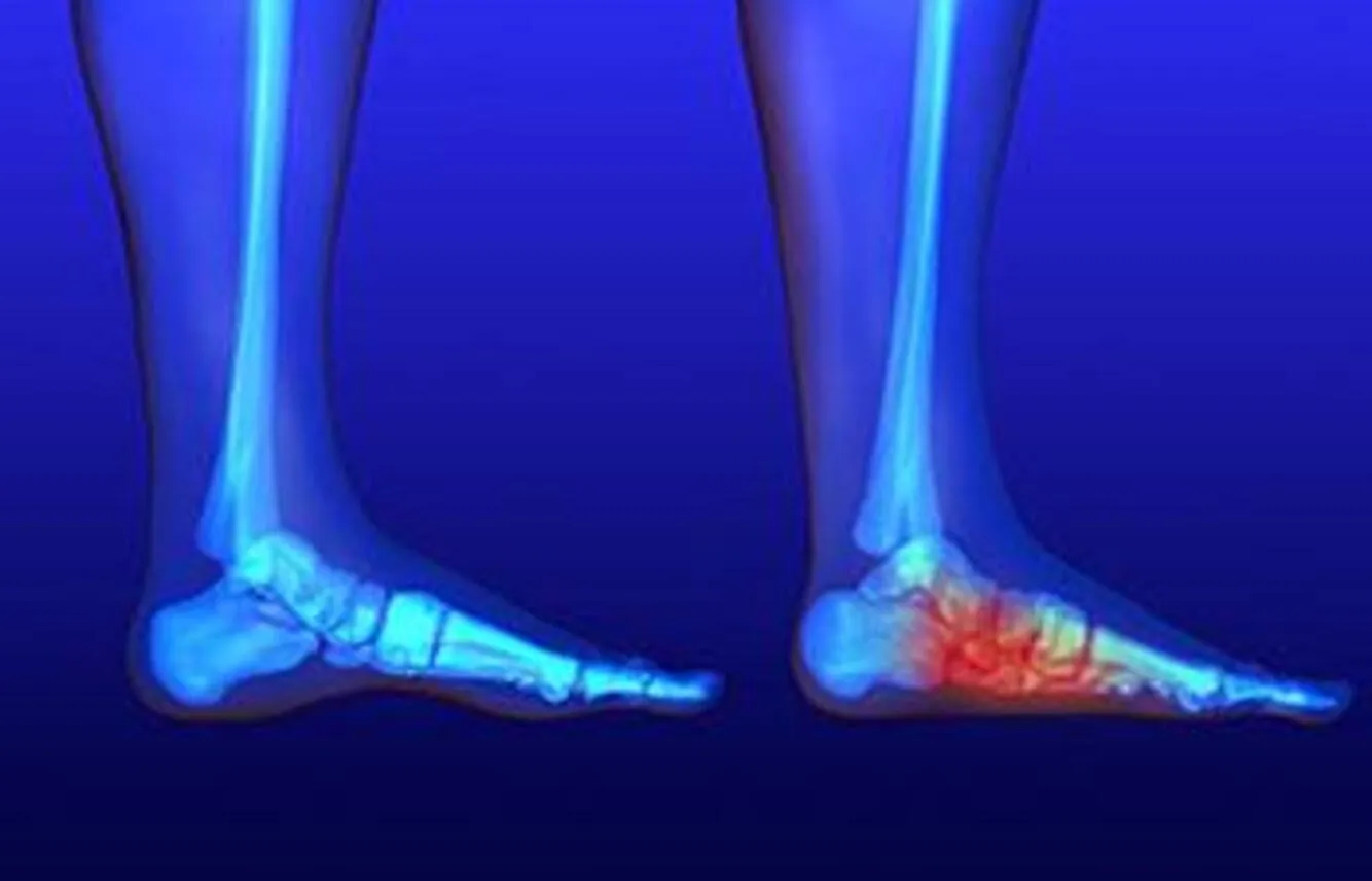 Deformity Correction in Pimpri-Chinchwad