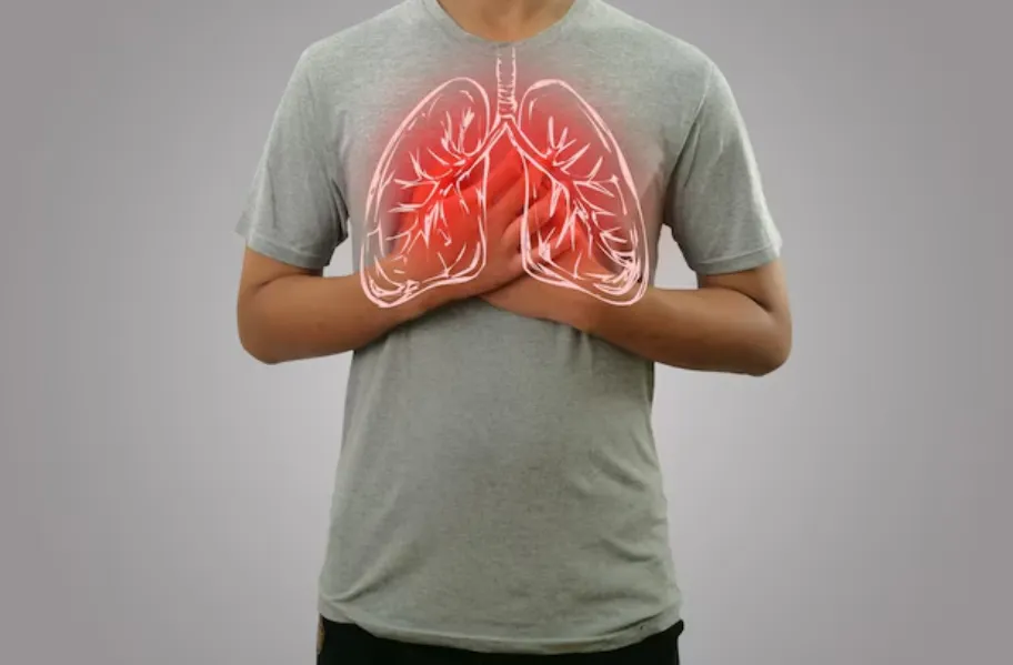 Pleural Effusion Treatment in Jaipur – Relieving Chest Fluid Problems