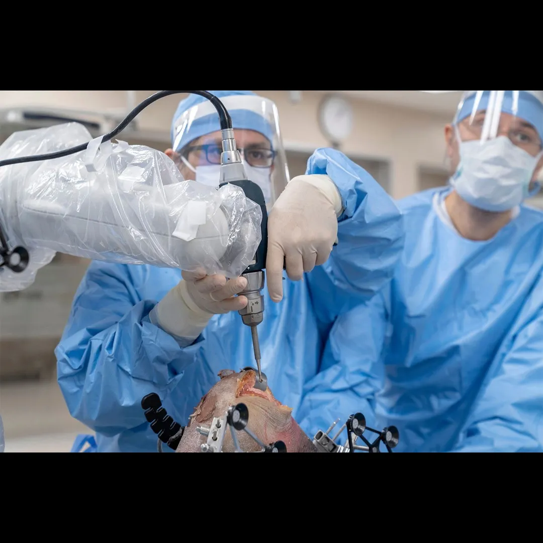 Robotic Assisted Knee Replacement in West Delhi – Next-Gen Joint Care