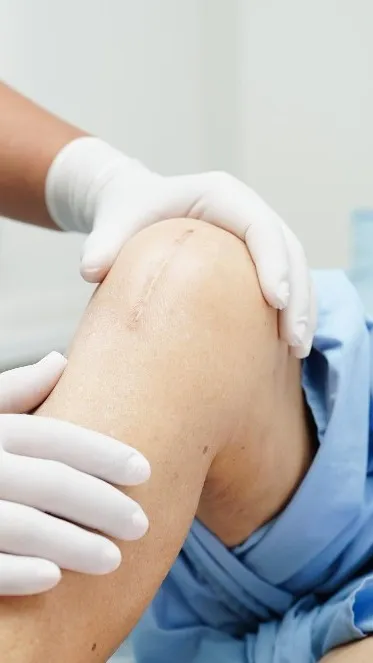 Joint Replacement Surgeon Near Me – Restoring Movement and Confidence