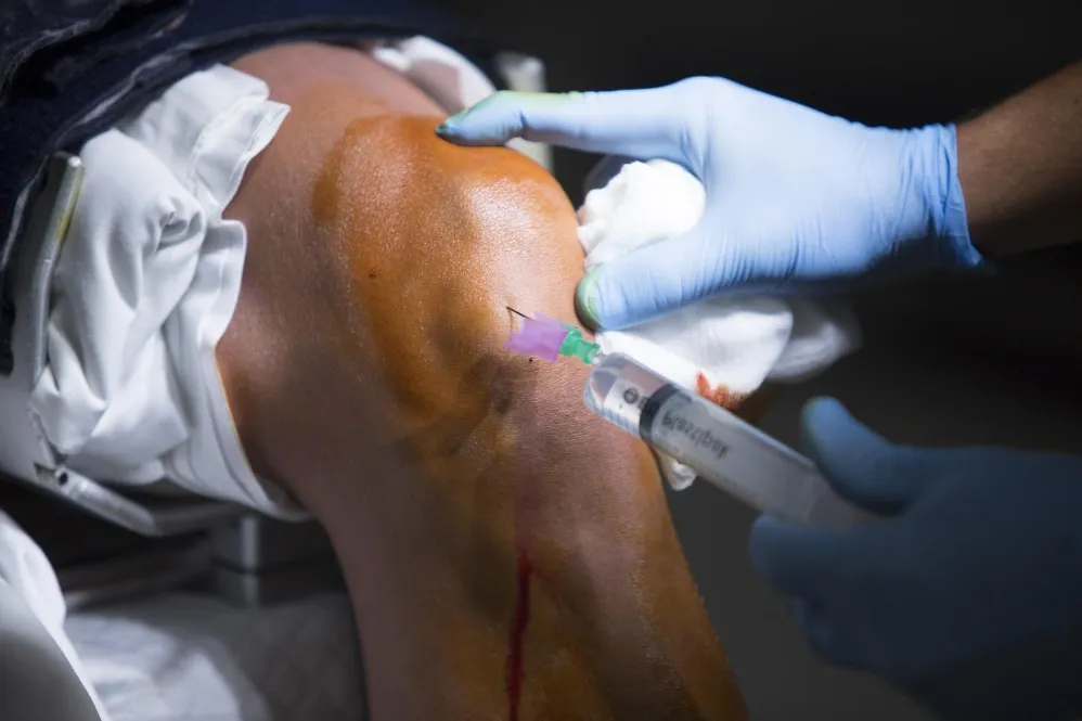Meniscal Repair in Bangalore – Protecting Knee Function for the Long Term