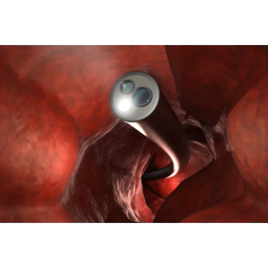 ESD (Endoscopic Submucosal Dissection) in Mumbai