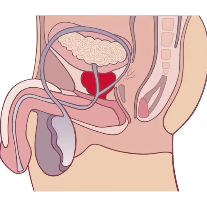 PESA in Nashik: A Trusted Option for Male Infertility Care