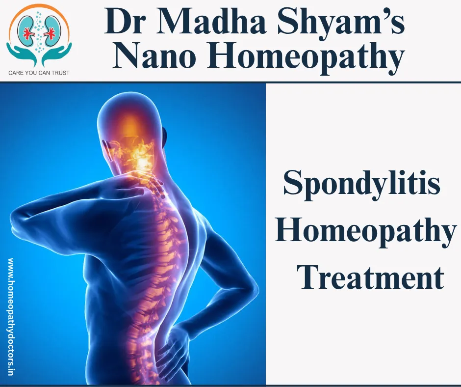 Spondylitis Homeopathy treatment