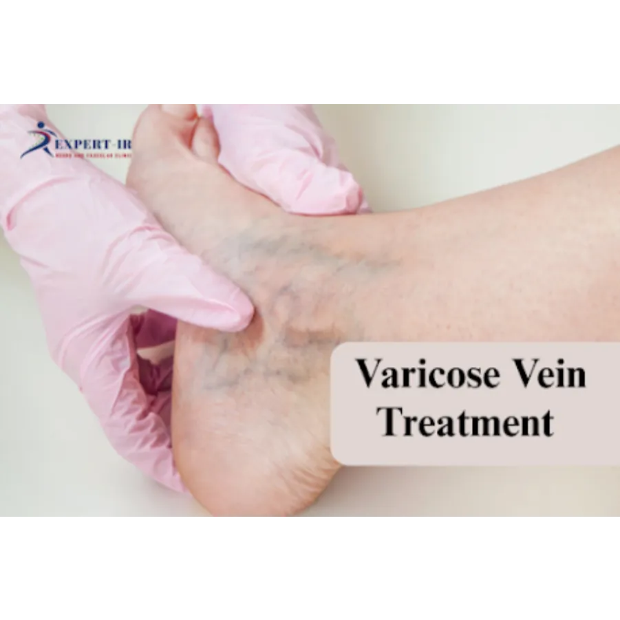 Looking for safe and effective treatment for varicose veins in Pune? or "varicose vein treatment nea...