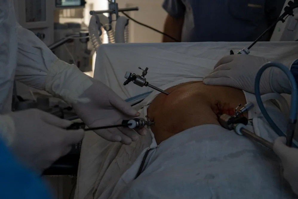 Laparoscopy in Wadala