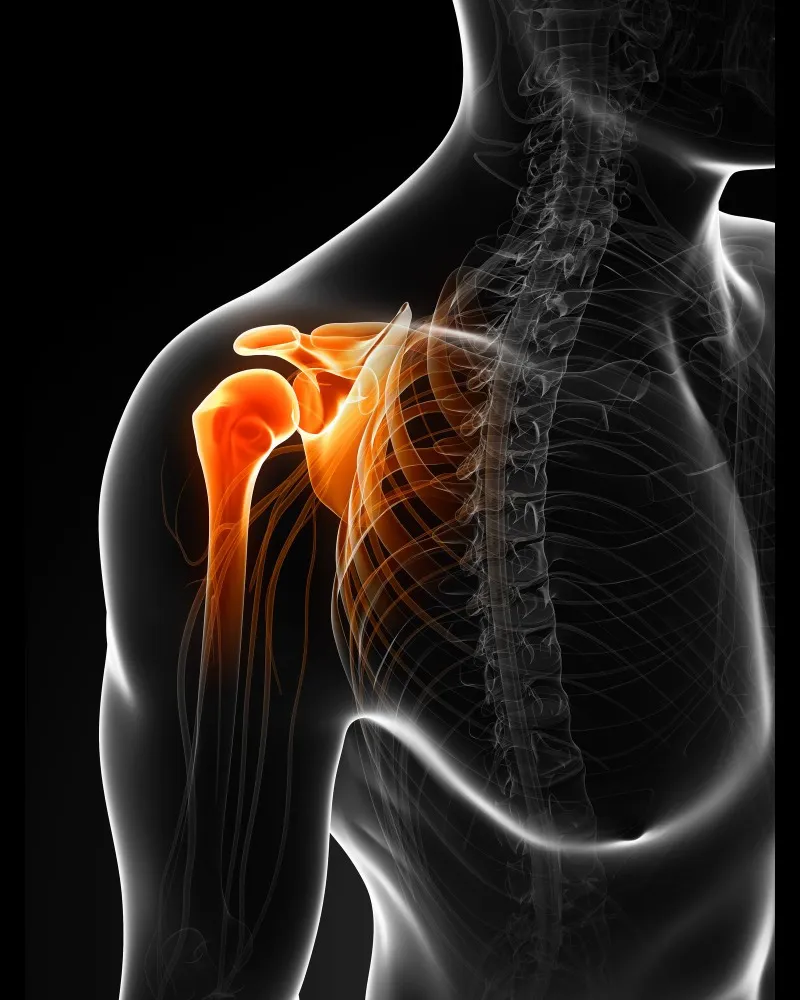 Trusted Shoulder Replacement in Nagarbhavi for Restoring Mobility