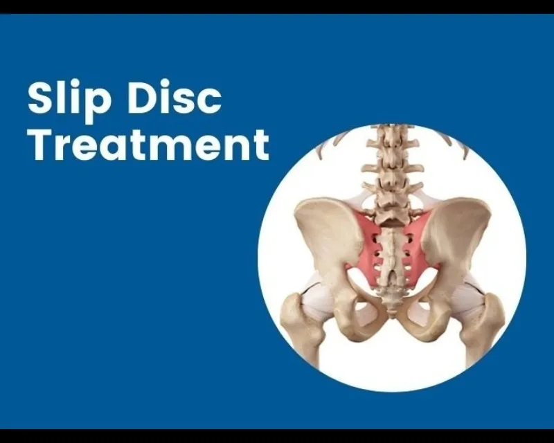Slip Disc Doctor in Nagpur – Find Relief from Pain...