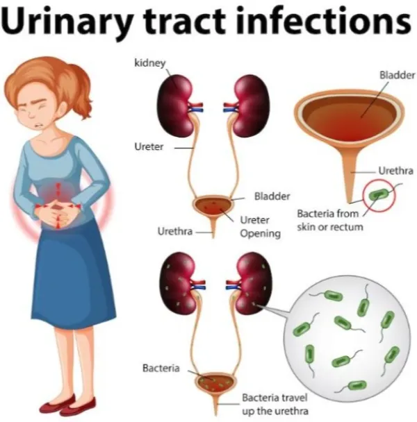 Urinary Infection Treatment in Thane – Restoring Comfort and Health