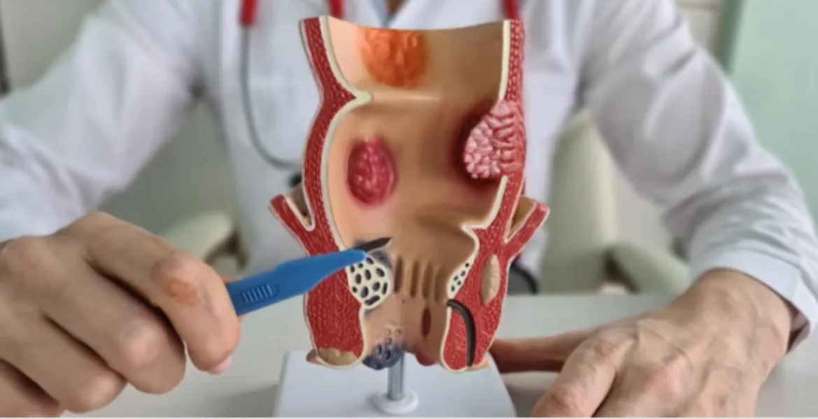 Fissure Treatment in Thergaon