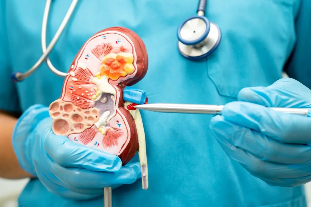 Best Kidney Stone Surgeon in Thane – Precision and Expertise