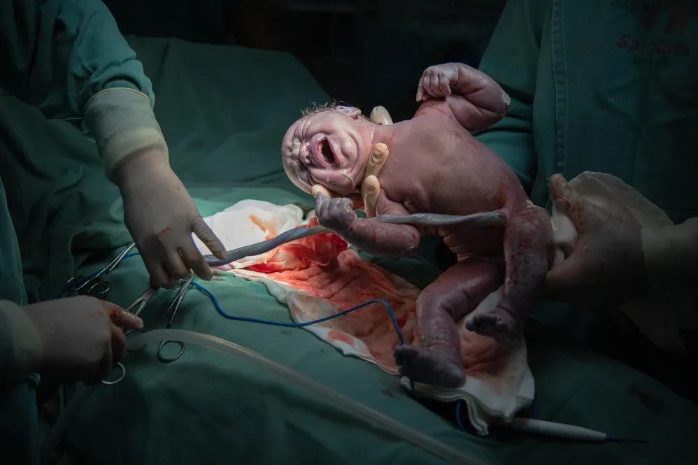 Cesarean Section in Mumbai