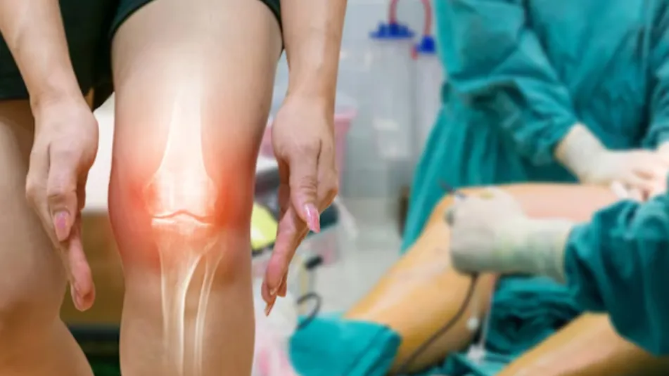 Revision Knee Replacement Specialist in Shalimar Bagh: