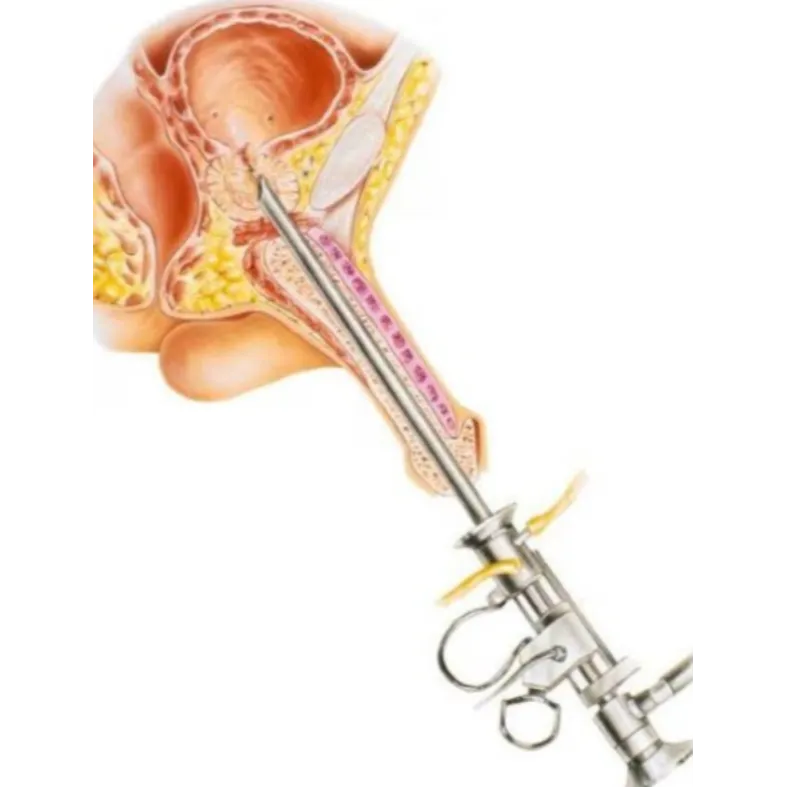 TURP in Thane – Modern Prostate Surgery Solutions
