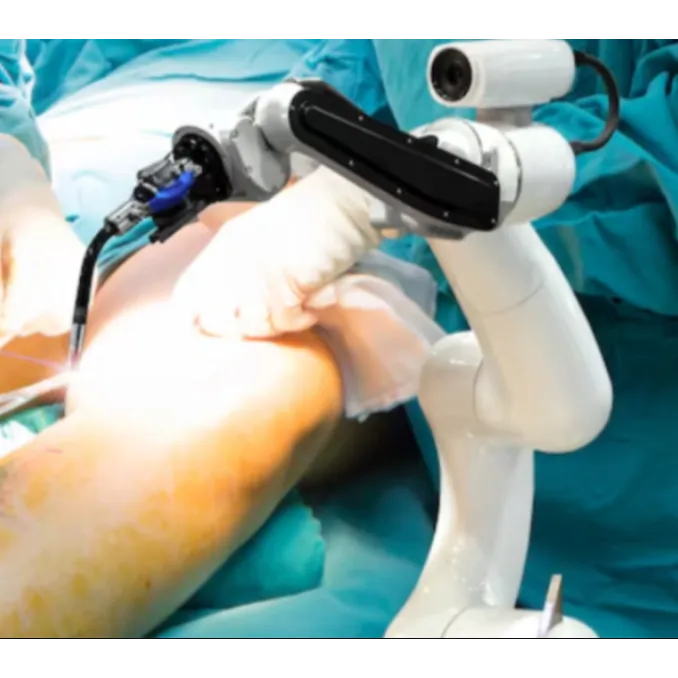 Robotic Knee Replacement in Hebbal