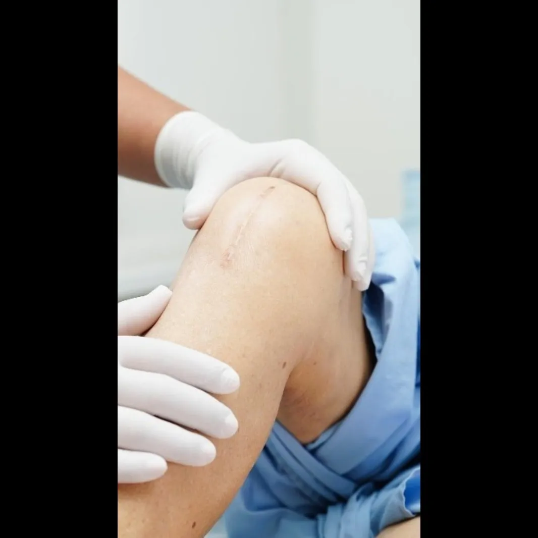 Joint Replacement Surgeon Near Me – Restoring Movement and Confidence