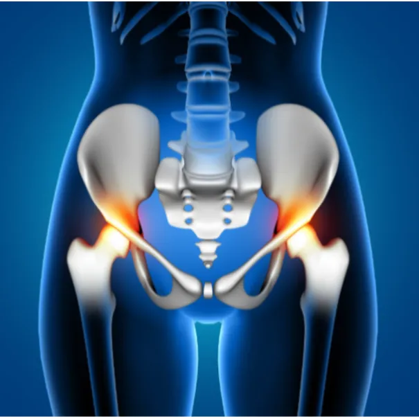 Hip Replacement in Yelahanka