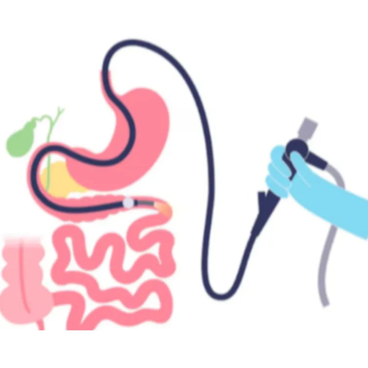 Double Balloon Enteroscopy in Mumbai
