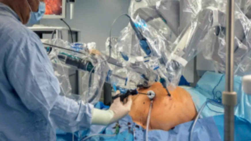 Robotic Cholecystectomy for Gall Stone in Dasarahalli