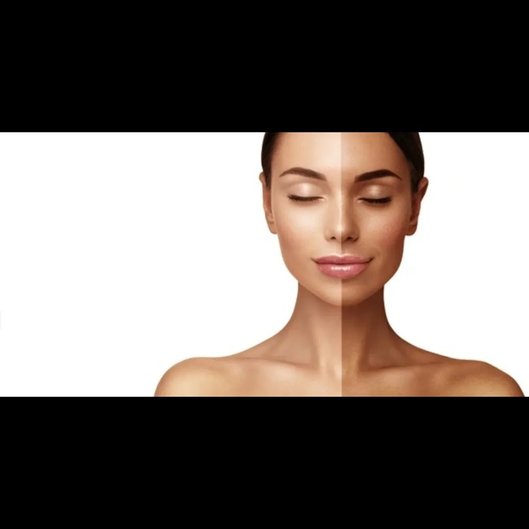 De tan treatment in Delhi