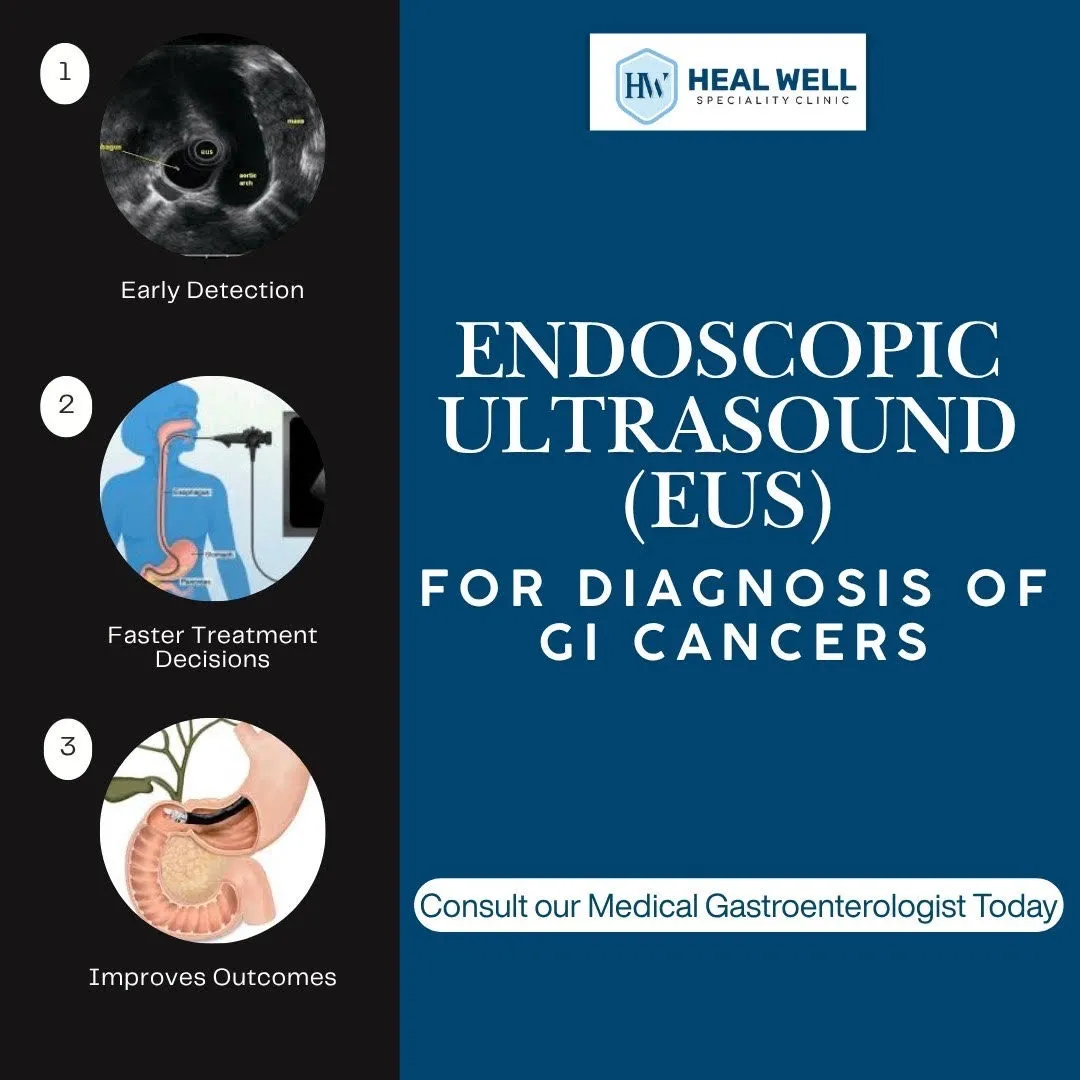 EUS for diagnosis of GI cancer in Thane