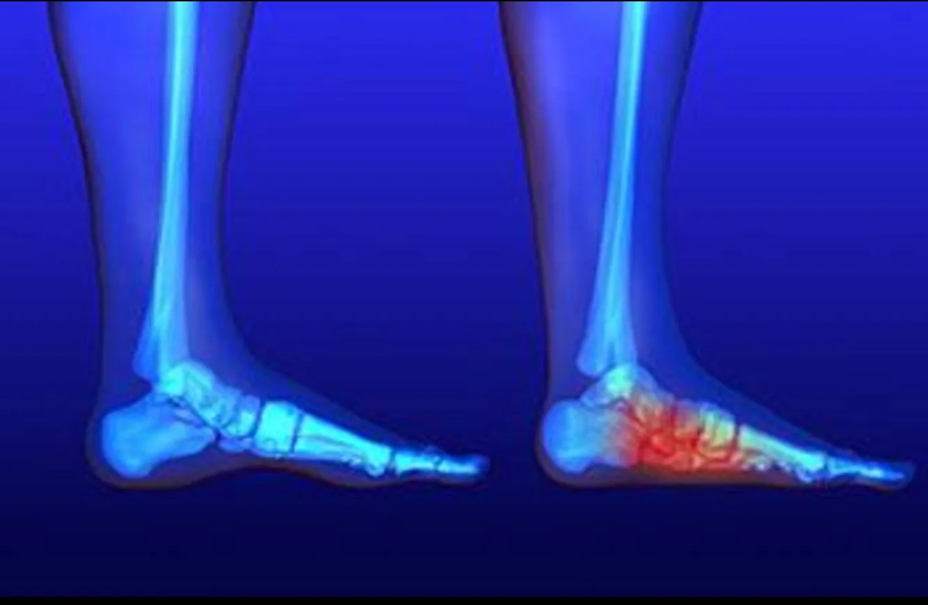 Deformity Correction in Pimpri-Chinchwad