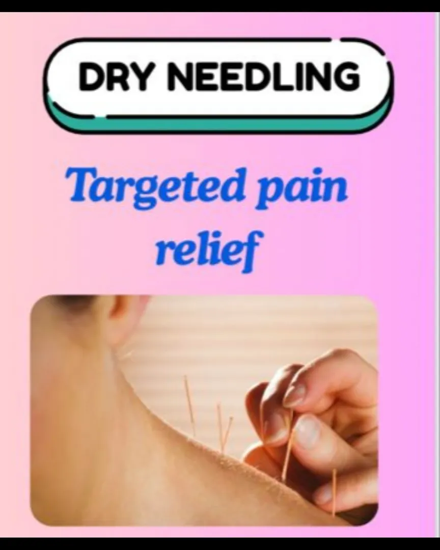 Dry needling treatment.