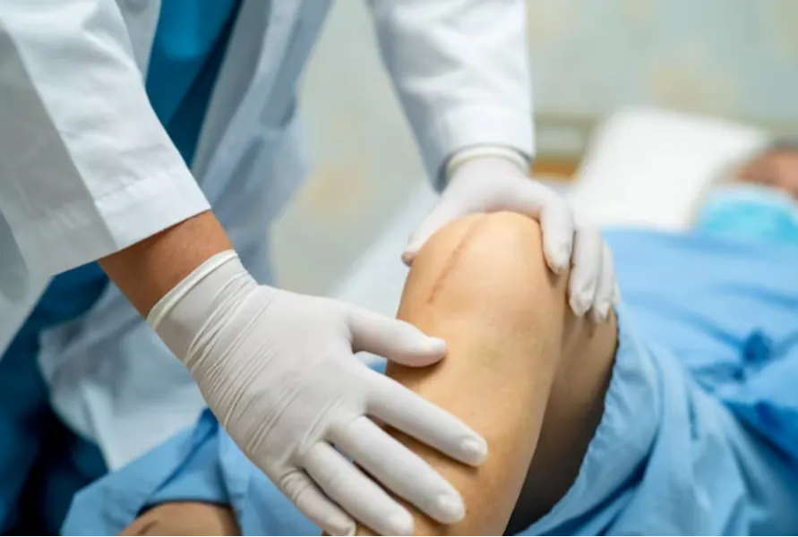 Revision Knee Surgery in Delhi