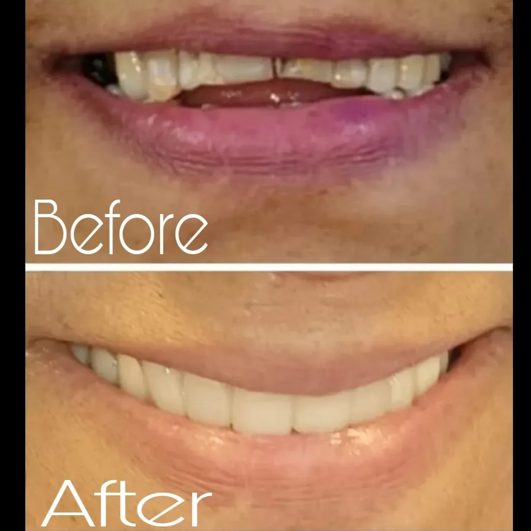 SMILE DESIGNING