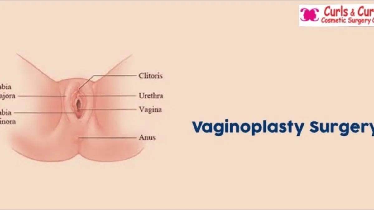 Vaginal Tightening in Bangalore – Restoring Confidence and Comfort