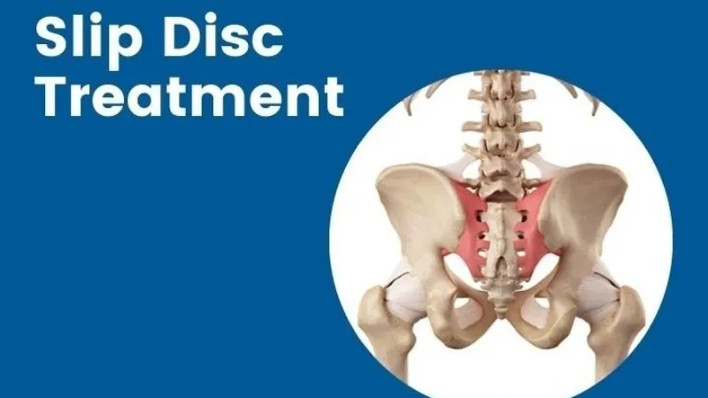 Slip Disc Doctor in Nagpur – Find Lasting Relief from Back Pain