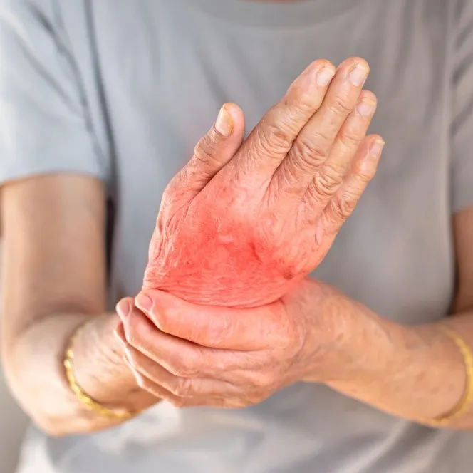 Arthritis Doctor in Nagpur – Expert Orthopedic Care to Restore Comfort and Mobility