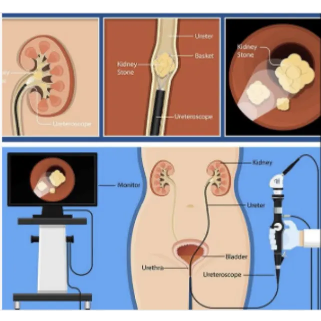 Best Urology Hospital in Ahmedabad