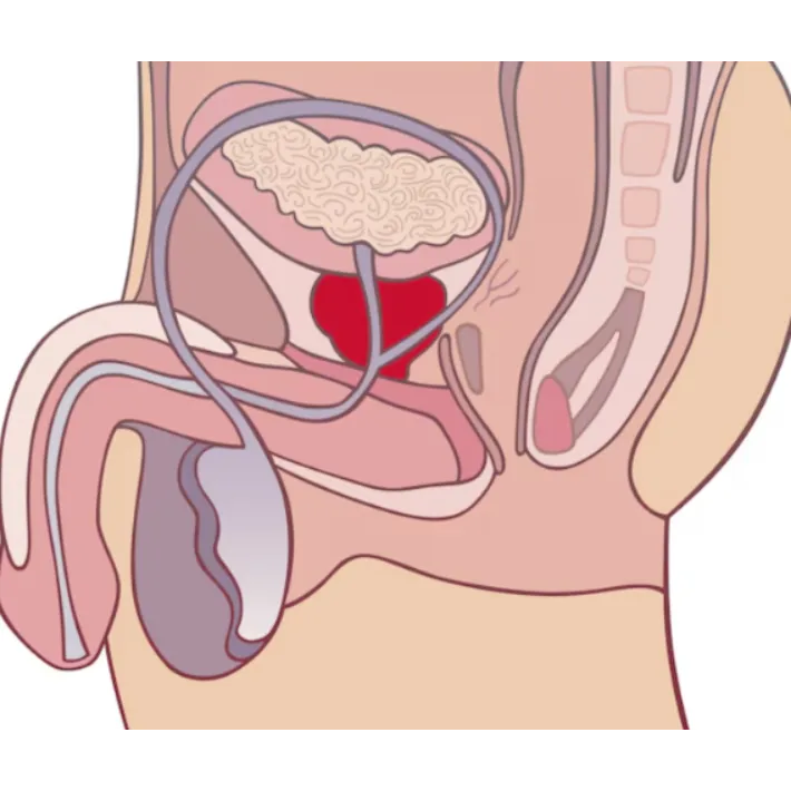 TESA / PESA (Sperm Retrieval Techniques) in Nashik – Advanced Male Fertility Care