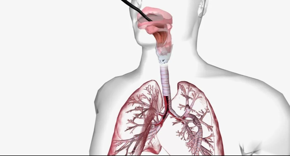 Bronchoscopy in Jaipur – Accurate Diagnosis of Lung Conditions