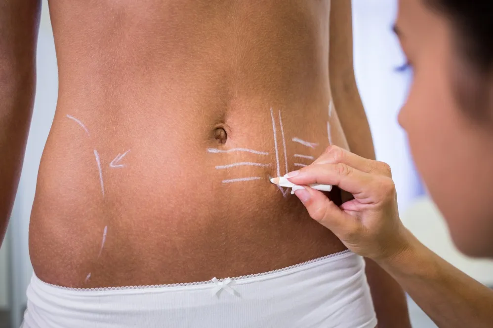 Lipoma Removal in Chembur - Safe and Simple Treatment with Expert Care