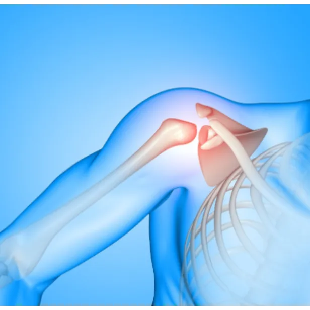 Reverse Shoulder Replacement in Bangalore – Freedom from Shoulder Pain