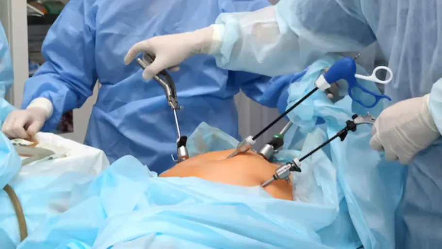 Laparoscopic Surgeries in Nashik – Advanced Care for Women’s Health