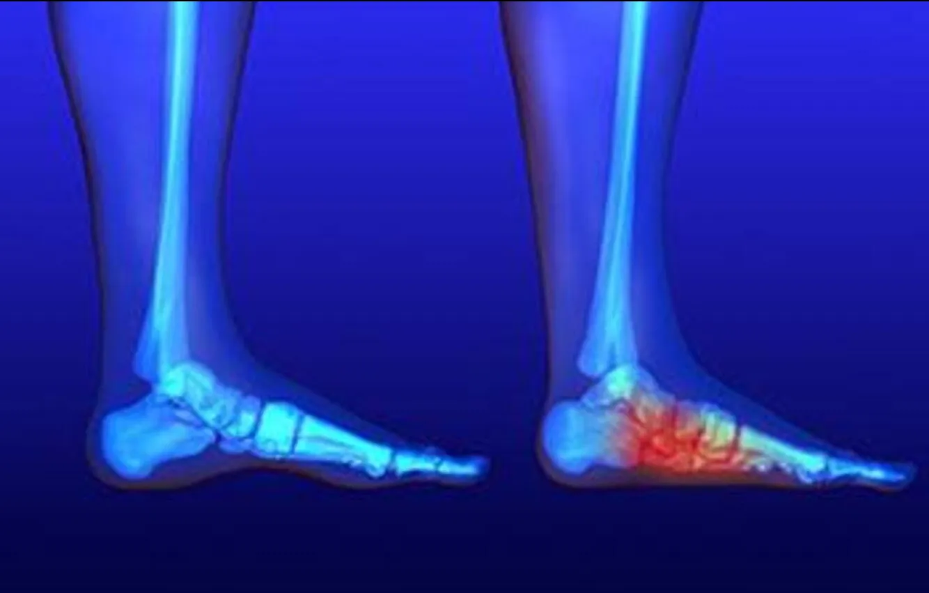 Deformity Correction in Pimpri-Chinchwad